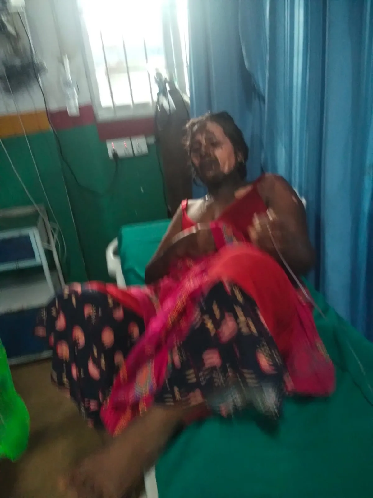 सुर्खेतमा श्रीमानले श्रीमतीमाथि पेट्रोल छर्केर लगाए आगो