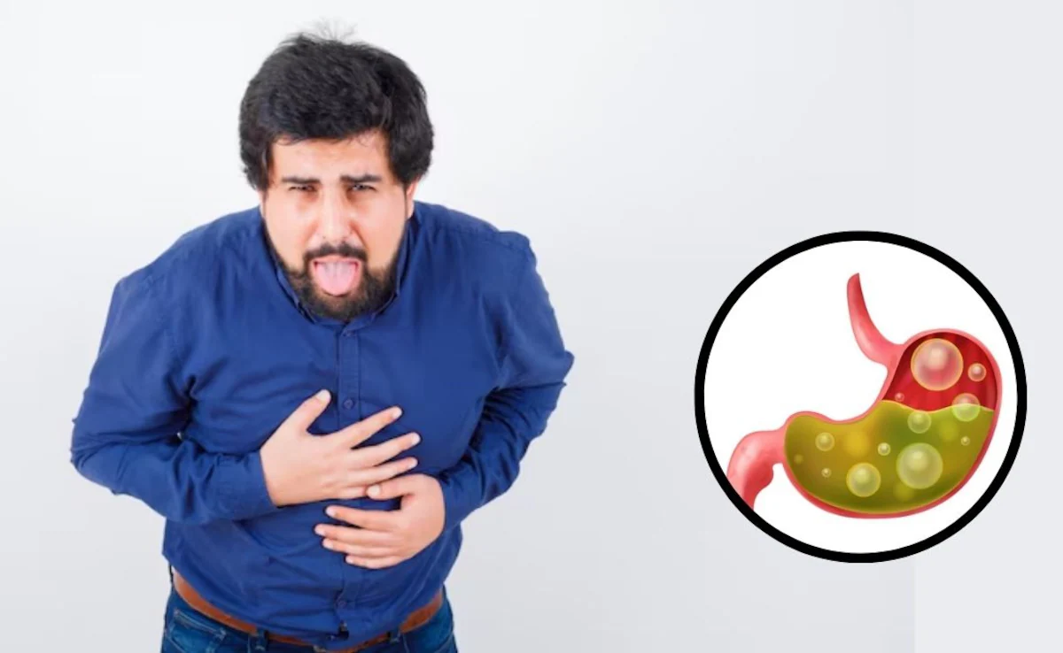 एसिडिटीको समस्याबाट बच्न चाहनुहुन्छ ? यी ६ टिप्सले ल्याउँछ तुरुन्त राहत