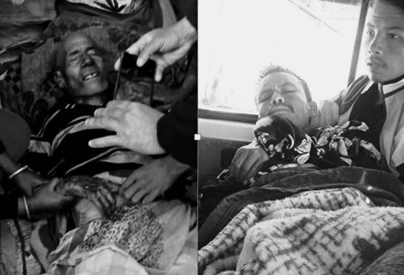 दैलेखमा बँदेलको आक्रमणबाट एकको मृत्यु, दुई जना घाइते