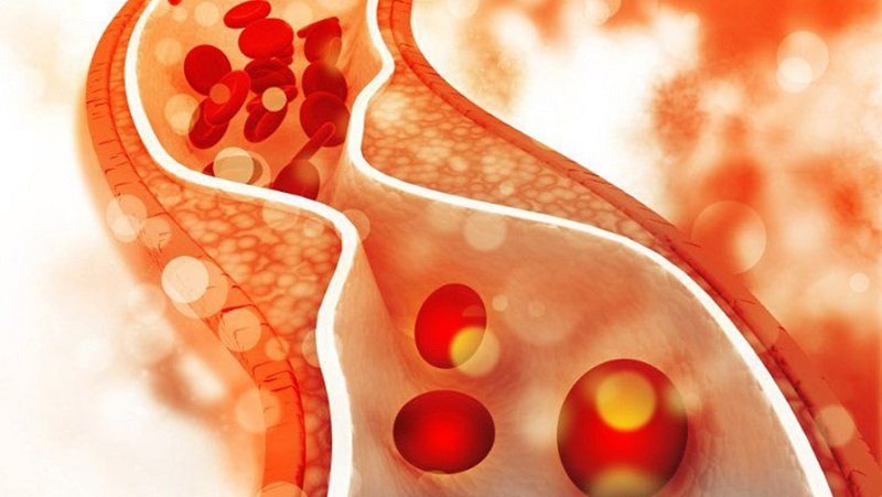 कोलेस्ट्रोल नियन्त्रण गर्न के गर्ने?